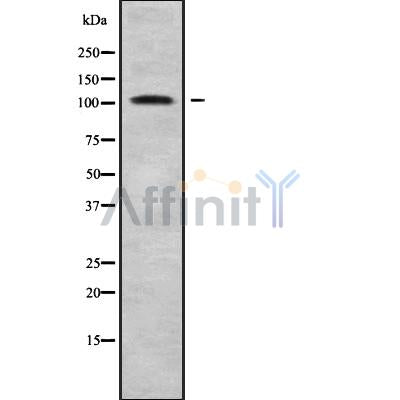 Western blot analysis of extracts from Hepg2, using EDEM3 Antibody. Lane 1 was treated with the blocking peptide.