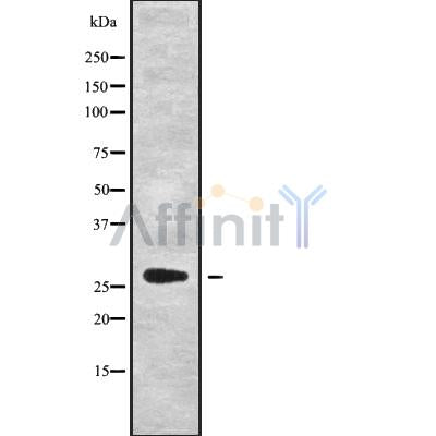 Western blot analysis of HSD17B8 using A549 whole cell lysates