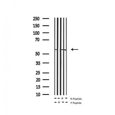 AF3114 staining 293 by IF/ICC. The sample were fixed with PFA and permeabilized in 0.1% Triton X-100,then blocked in 10% serum for 45 minutes at 25¡ãC. The primary antibody was diluted at 1/200 and incubated with the sample for 1 hour at 37¡ãC. An  Alexa Fluor 594 conjugated goat anti-rabbit IgG (H+L) Ab, diluted at 1/600, was used as the secondary antibod