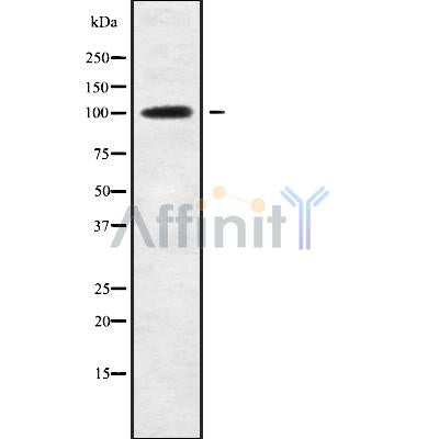 Western blot analysis of ETAA1 using RAW264.7 whole cell lysates