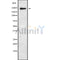 DF9513 at 1/100 staining Rat kidney tissue by IHC-P. The sample was formaldehyde fixed and a heat mediated antigen retrieval step in citrate buffer was performed. The sample was then blocked and incubated with the antibody for 1.5 hours at 22¡ãC. An HRP conjugated goat anti-rabbit antibody was used as the secondary