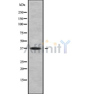 Western blot analysis FAIM2 using COLO205 whole cell lysates