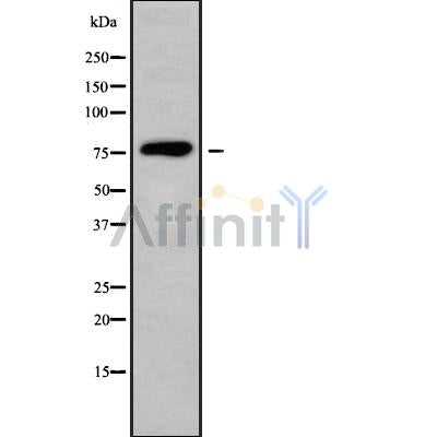 DF9516 at 1/100 staining Human Melanoma tissue by IHC-P. The sample was formaldehyde fixed and a heat mediated antigen retrieval step in citrate buffer was performed. The sample was then blocked and incubated with the antibody for 1.5 hours at 22¡ãC. An HRP conjugated goat anti-rabbit antibody was used as the secondary