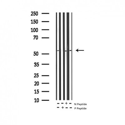 AF3115 staining 293 by IF/ICC. The sample were fixed with PFA and permeabilized in 0.1% Triton X-100,then blocked in 10% serum for 45 minutes at 25¡ãC. The primary antibody was diluted at 1/200 and incubated with the sample for 1 hour at 37¡ãC. An  Alexa Fluor 594 conjugated goat anti-rabbit IgG (H+L) Ab, diluted at 1/600, was used as the secondary antibod