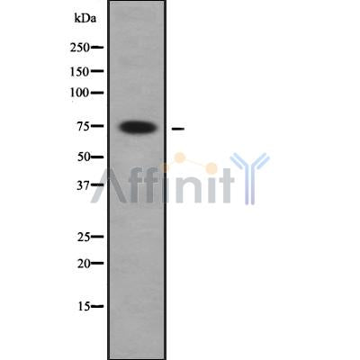 Western blot analysis FIGNL1 using HeLa whole cell lysates