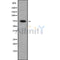 Western blot analysis FIGNL1 using HeLa whole cell lysates