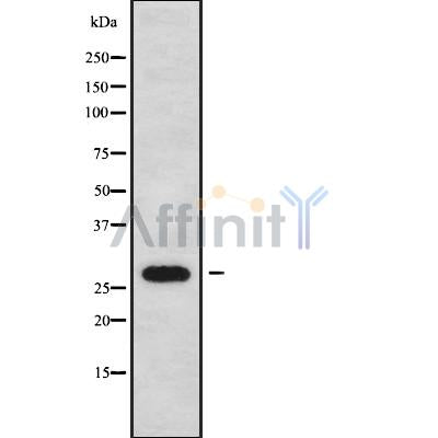 Western blot analysis FOLR2 using HeLa whole cell lysates