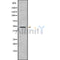 Western blot analysis FOXD4L5 using COLO205 whole cell lysates