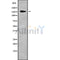 DF9522 at 1/100 staining Mouse lung tissue by IHC-P. The sample was formaldehyde fixed and a heat mediated antigen retrieval step in citrate buffer was performed. The sample was then blocked and incubated with the antibody for 1.5 hours at 22¡ãC. An HRP conjugated goat anti-rabbit antibody was used as the secondary