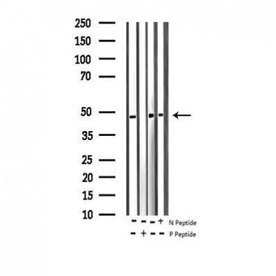 AF3118 staining 293 by IF/ICC. The sample were fixed with PFA and permeabilized in 0.1% Triton X-100,then blocked in 10% serum for 45 minutes at 25¡ãC. The primary antibody was diluted at 1/200 and incubated with the sample for 1 hour at 37¡ãC. An  Alexa Fluor 594 conjugated goat anti-rabbit IgG (H+L) Ab, diluted at 1/600, was used as the secondary antibod