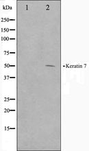 Western blot analysis on HepG2 cell lysate using Keratin 7 Antibody