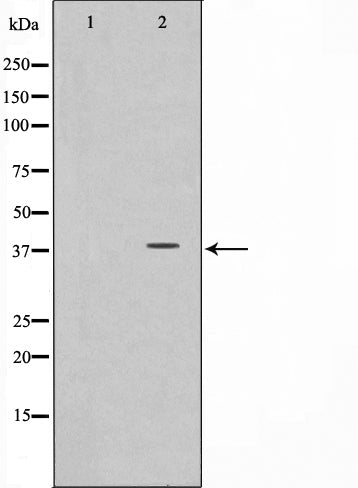 Western blot analysis on COS7 cell lysate using CD226/DNAM-1 Antibody.The lane on the left is treated with the antigen-specific peptide.