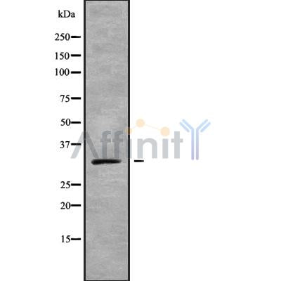 Western blot analysis GJB5 using HepG2 whole cell lysates