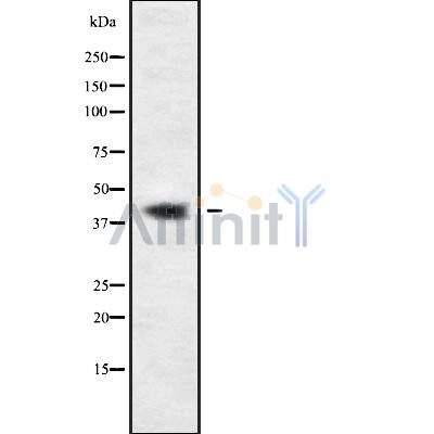 Western blot analysis GMDS using COLO205 whole cell lysates