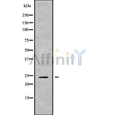 DF9532 at 1/100 staining Human Melanoma tissue by IHC-P. The sample was formaldehyde fixed and a heat mediated antigen retrieval step in citrate buffer was performed. The sample was then blocked and incubated with the antibody for 1.5 hours at 22¡ãC. An HRP conjugated goat anti-rabbit antibody was used as the secondary