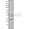 DF9532 at 1/100 staining Human Melanoma tissue by IHC-P. The sample was formaldehyde fixed and a heat mediated antigen retrieval step in citrate buffer was performed. The sample was then blocked and incubated with the antibody for 1.5 hours at 22¡ãC. An HRP conjugated goat anti-rabbit antibody was used as the secondary