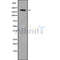 DF9533 at 1/100 staining Mouse kidney tissue by IHC-P. The sample was formaldehyde fixed and a heat mediated antigen retrieval step in citrate buffer was performed. The sample was then blocked and incubated with the antibody for 1.5 hours at 22¡ãC. An HRP conjugated goat anti-rabbit antibody was used as the secondary