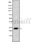 Western blot analysis of PTGDS2 using Jurkat whole cell lysates