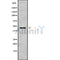 DF9536 at 1/100 staining Mouse kidney tissue by IHC-P. The sample was formaldehyde fixed and a heat mediated antigen retrieval step in citrate buffer was performed. The sample was then blocked and incubated with the antibody for 1.5 hours at 22¡ãC. An HRP conjugated goat anti-rabbit antibody was used as the secondary