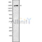 DF9537 at 1/100 staining Rat brain tissue by IHC-P. The sample was formaldehyde fixed and a heat mediated antigen retrieval step in citrate buffer was performed. The sample was then blocked and incubated with the antibody for 1.5 hours at 22¡ãC. An HRP conjugated goat anti-rabbit antibody was used as the secondary