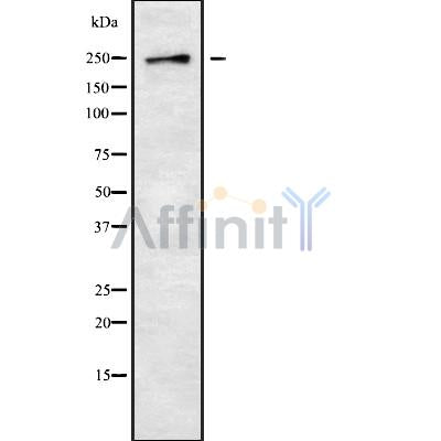 DF9537 at 1/100 staining Rat brain tissue by IHC-P. The sample was formaldehyde fixed and a heat mediated antigen retrieval step in citrate buffer was performed. The sample was then blocked and incubated with the antibody for 1.5 hours at 22¡ãC. An HRP conjugated goat anti-rabbit antibody was used as the secondary
