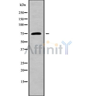 DF9539 at 1/100 staining Mouse colon tissue by IHC-P. The sample was formaldehyde fixed and a heat mediated antigen retrieval step in citrate buffer was performed. The sample was then blocked and incubated with the antibody for 1.5 hours at 22¡ãC. An HRP conjugated goat anti-rabbit antibody was used as the secondary