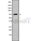 DF9539 at 1/100 staining Mouse colon tissue by IHC-P. The sample was formaldehyde fixed and a heat mediated antigen retrieval step in citrate buffer was performed. The sample was then blocked and incubated with the antibody for 1.5 hours at 22¡ãC. An HRP conjugated goat anti-rabbit antibody was used as the secondary