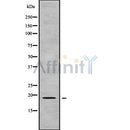 Western blot analysis of extracts from 3T3-L1, using GPSM3 Antibody. Lane 1 was treated with the blocking peptide.