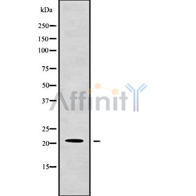 Western blot analysis of CSF3 using Jurkat whole cell lysates