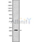 Western blot analysis of CSF3 using Jurkat whole cell lysates