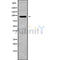 Western blot analysis of CSF3R using COS7 whole cell lysates