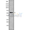 DF9545 at 1/100 staining Human brain cancer tissue by IHC-P. The sample was formaldehyde fixed and a heat mediated antigen retrieval step in citrate buffer was performed. The sample was then blocked and incubated with the antibody for 1.5 hours at 22¡ãC. An HRP conjugated goat anti-rabbit antibody was used as the secondary