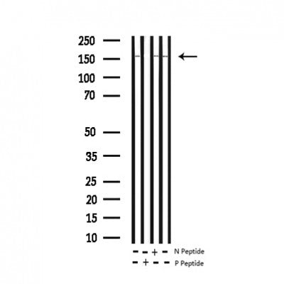 Western blot analysis of extracts from ret transfected 293 cells lysates, using Phospho-Ret (Tyr1062) Antibody.
Lane1: Phosphotyrosine mAb at 1:2000;
Lane2: Ret (Phospho-Tyr905) Antibody(AF8055) at 1:2000;
Lane3: Phospho-Ret (Tyr1062) Antibody(AF3120) at 1:2000.