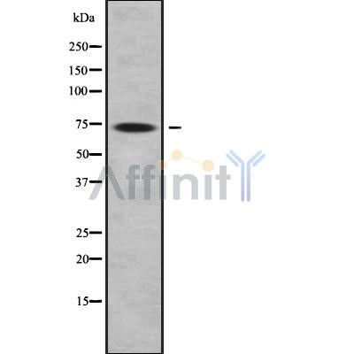 Western blot analysis of extracts from mouse brain, using GTPBP1 Antibody. Lane 1 was treated with the blocking peptide.