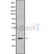 Western blot analysis of DIRAS2 using Jurkat whole cell lysates