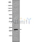 Western blot analysis of extracts from Mouse muscle, using SAR1A Antibody. The lane on the left was treated with blocking peptide.