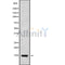 DF9555 at 1/100 staining Human breast cancer tissue by IHC-P. The sample was formaldehyde fixed and a heat mediated antigen retrieval step in citrate buffer was performed. The sample was then blocked and incubated with the antibody for 1.5 hours at 22¡ãC. An HRP conjugated goat anti-rabbit antibody was used as the secondary