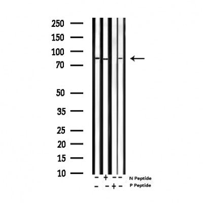 AF3121 staining A549 by IF/ICC. The sample were fixed with PFA and permeabilized in 0.1% Triton X-100,then blocked in 10% serum for 45 minutes at 25¡ãC. The primary antibody was diluted at 1/200 and incubated with the sample for 1 hour at 37¡ãC. An  Alexa Fluor 594 conjugated goat anti-rabbit IgG (H+L) Ab, diluted at 1/600, was used as the secondary antibod