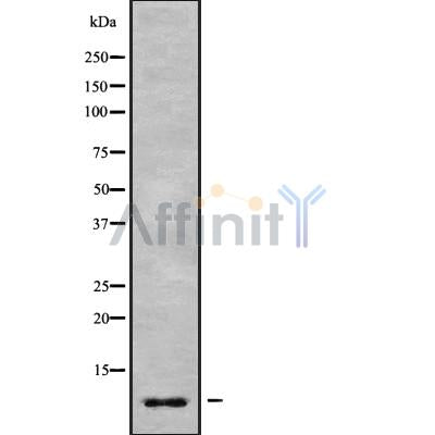 DF9562 staining HEPG2 cells by IF/ICC. The sample were fixed with PFA and permeabilized in 0.1% Triton X-100,then blocked in 10% serum for 45 minutes at 25¡ãC. The primary antibody was diluted at 1/200 and incubated with the sample for 1 hour at 37¡ãC. An  Alexa Fluor 594 conjugated goat anti-rabbit IgG (H+L) antibody(Cat.# S0006), diluted at 1/600 was used as secondary antibod