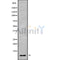 DF9562 staining HEPG2 cells by IF/ICC. The sample were fixed with PFA and permeabilized in 0.1% Triton X-100,then blocked in 10% serum for 45 minutes at 25¡ãC. The primary antibody was diluted at 1/200 and incubated with the sample for 1 hour at 37¡ãC. An  Alexa Fluor 594 conjugated goat anti-rabbit IgG (H+L) antibody(Cat.# S0006), diluted at 1/600 was used as secondary antibod