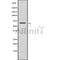 Western blot analysis GBP5 using COLO205 whole cell lysates