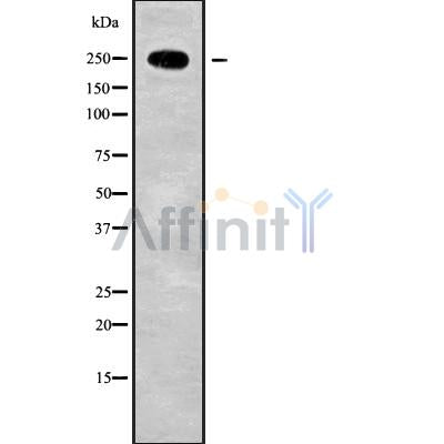 Western blot analysis of extracts from mouse brain, using HEATR1 Antibody. Lane 1 was treated with the blocking peptide.