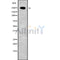 Western blot analysis of extracts from mouse brain, using HEATR1 Antibody. Lane 1 was treated with the blocking peptide.
