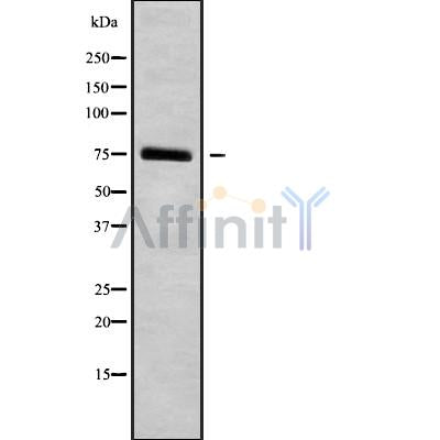 Western blot analysis of extracts from various samples, using HGFAC Antibody.
 Lane 1: hybridoma cells treated with blocking peptide.
 Lane 2: hybridoma cells;
 Lane 3: 293;
 