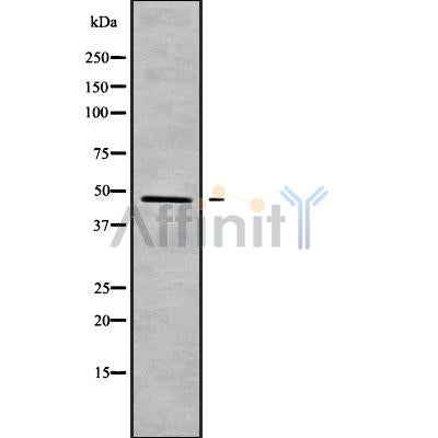 DF9571 at 1/100 staining Mouse pancreas tissue by IHC-P. The sample was formaldehyde fixed and a heat mediated antigen retrieval step in citrate buffer was performed. The sample was then blocked and incubated with the antibody for 1.5 hours at 22¡ãC. An HRP conjugated goat anti-rabbit antibody was used as the secondary