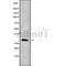 DF9572 at 1/100 staining Rat kidney tissue by IHC-P. The sample was formaldehyde fixed and a heat mediated antigen retrieval step in citrate buffer was performed. The sample was then blocked and incubated with the antibody for 1.5 hours at 22¡ãC. An HRP conjugated goat anti-rabbit antibody was used as the secondary