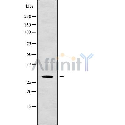 Western blot analysis of HLA-DMB using Jurkat whole cell lysates