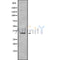 DF9575 at 1/100 staining Mouse spleen tissue by IHC-P. The sample was formaldehyde fixed and a heat mediated antigen retrieval step in citrate buffer was performed. The sample was then blocked and incubated with the antibody for 1.5 hours at 22¡ãC. An HRP conjugated goat anti-rabbit antibody was used as the secondary