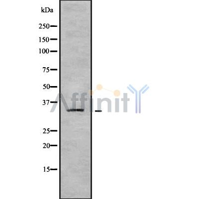 DF9575 at 1/100 staining Mouse spleen tissue by IHC-P. The sample was formaldehyde fixed and a heat mediated antigen retrieval step in citrate buffer was performed. The sample was then blocked and incubated with the antibody for 1.5 hours at 22¡ãC. An HRP conjugated goat anti-rabbit antibody was used as the secondary