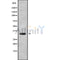 DF9576 at 1/100 staining Mouse lung tissue by IHC-P. The sample was formaldehyde fixed and a heat mediated antigen retrieval step in citrate buffer was performed. The sample was then blocked and incubated with the antibody for 1.5 hours at 22¡ãC. An HRP conjugated goat anti-rabbit antibody was used as the secondary